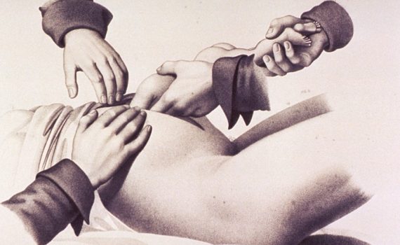 perimortem c-section