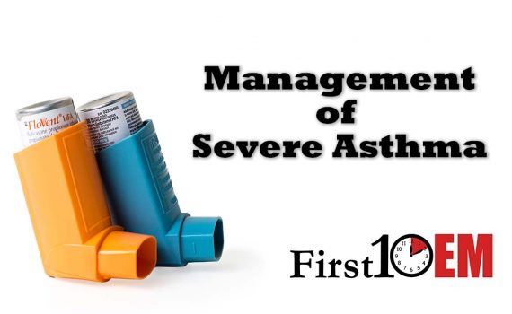 Management of severe asthma