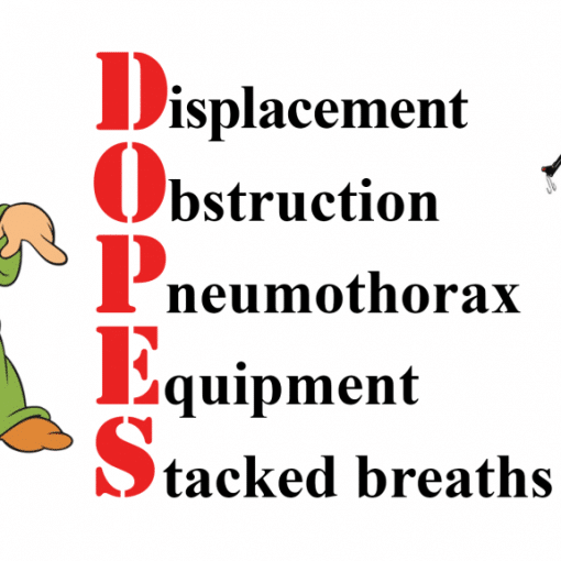 DOPES ventilator approach Post-intubation deterioration in asthma