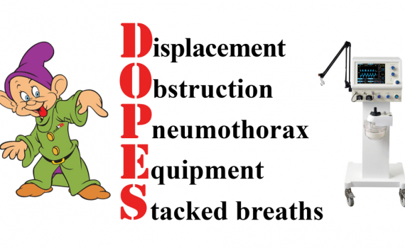 DOPES ventilator approach Post-intubation deterioration in asthma
