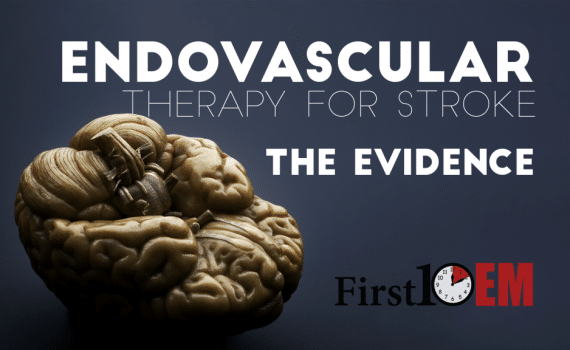 interventional therapy for stroke