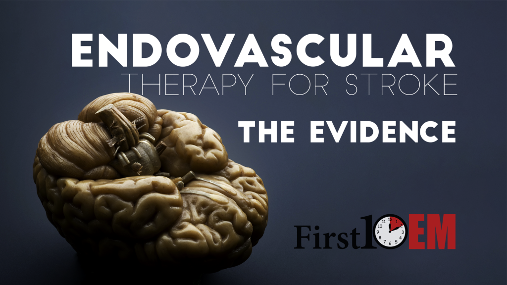 interventional therapy for stroke