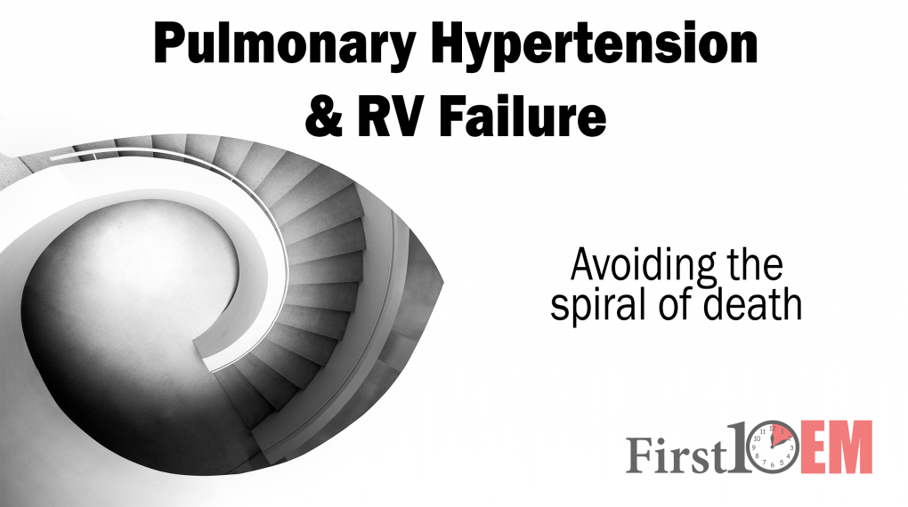 RV Failure
