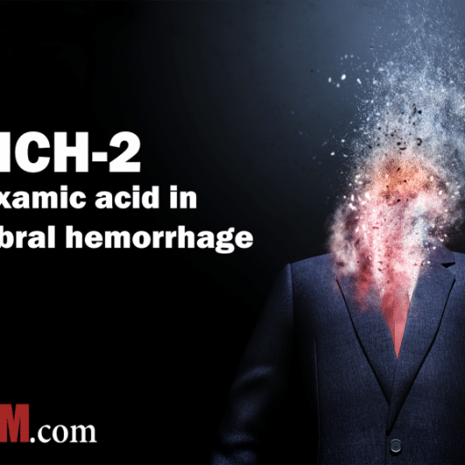 TICH 2 trial