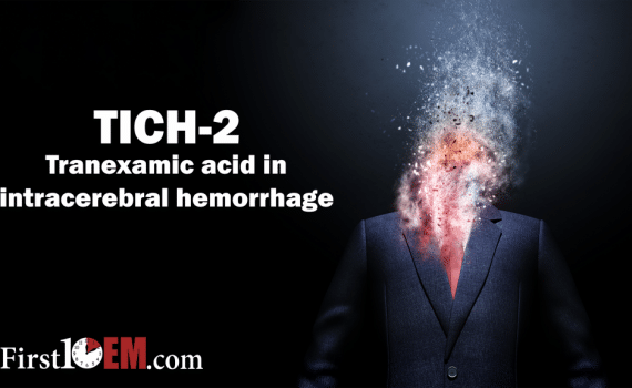 TICH 2 trial
