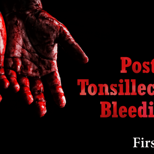 Tonsillectomy hemorrhage