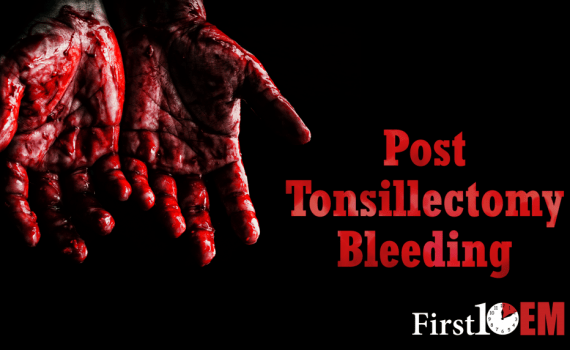 Tonsillectomy hemorrhage