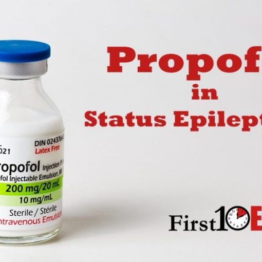 propofol in an aggressive seizure algorithm