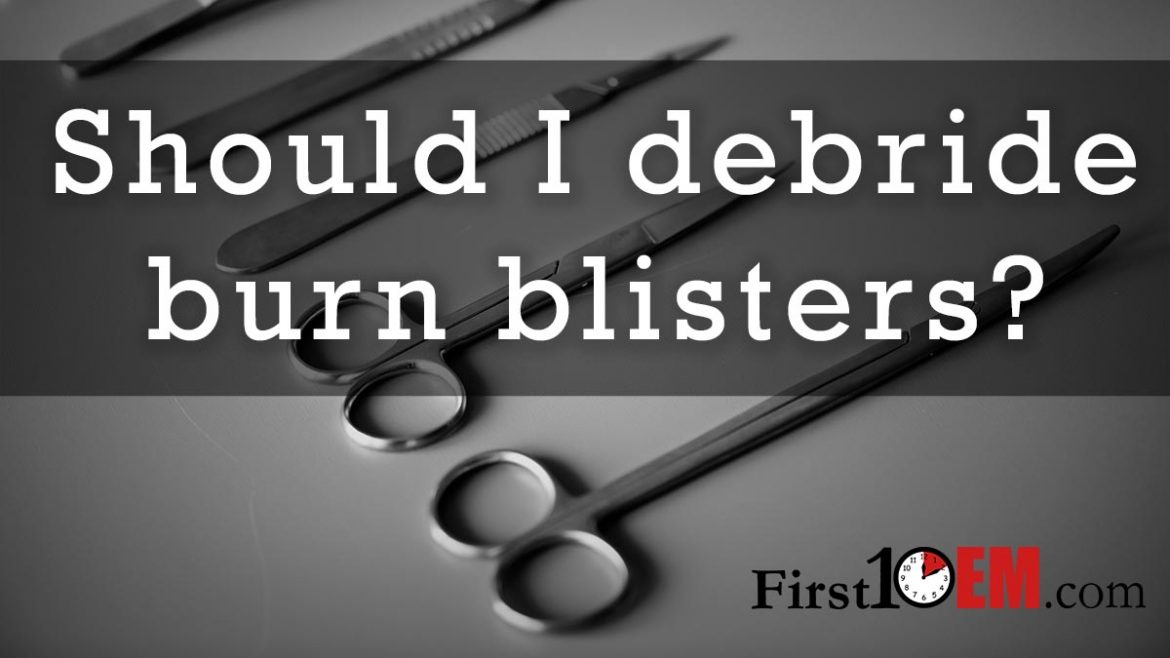 Should I debride burn blisters