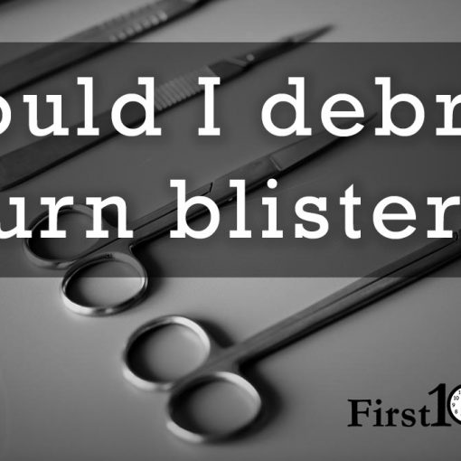 Should I debride burn blisters