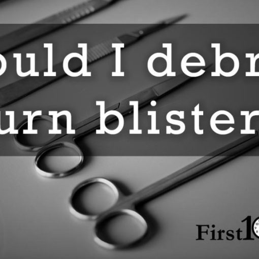 Should I debride burn blisters