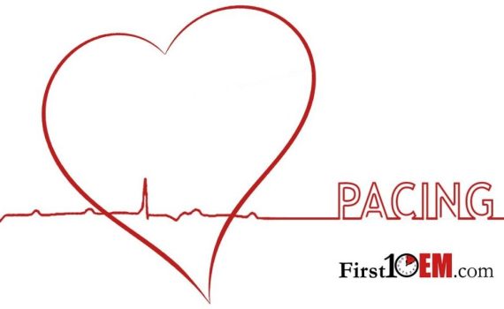 Cardiac pacing