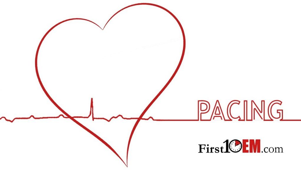 Cardiac pacing