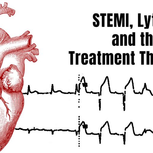 Treatment threshold in STEMI