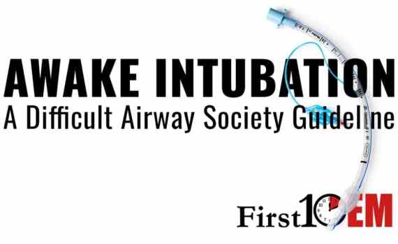 awake intubation guidelines