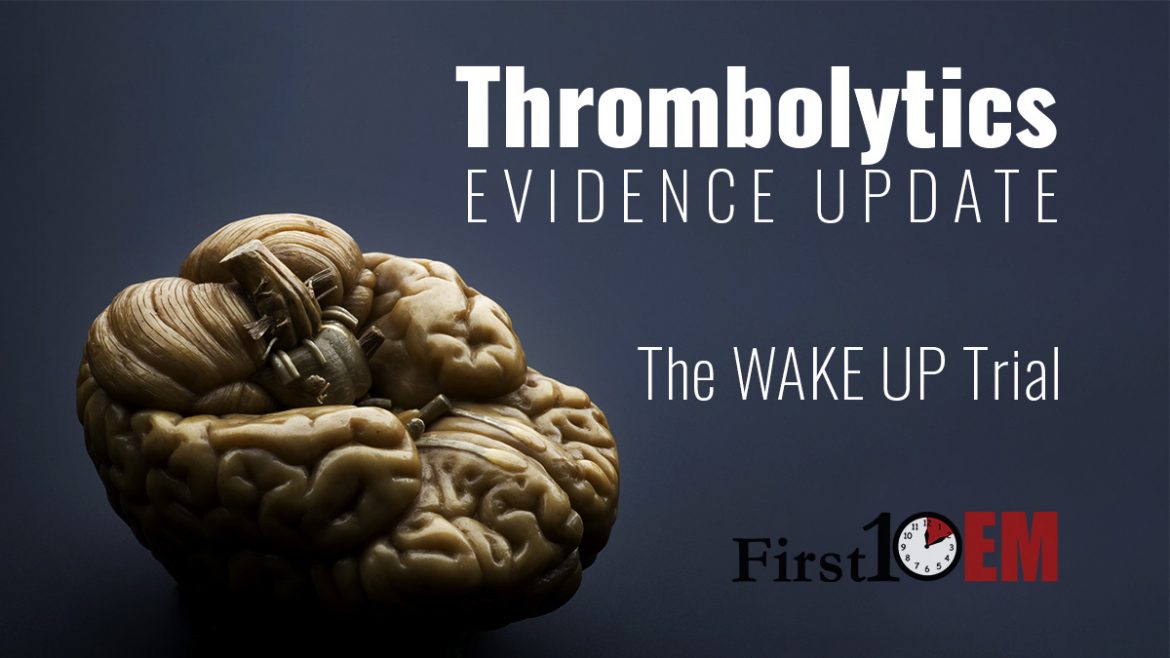 WAKE UP Trial