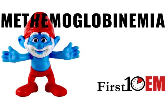 Methemoglobinemia Magement