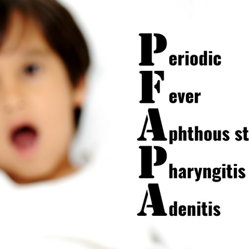Periodic fever, aphthous stomatitis, pharyngitis, and cervical adenitis (PFAPA) syndrome