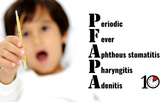 Periodic fever, aphthous stomatitis, pharyngitis, and cervical adenitis (PFAPA) syndrome