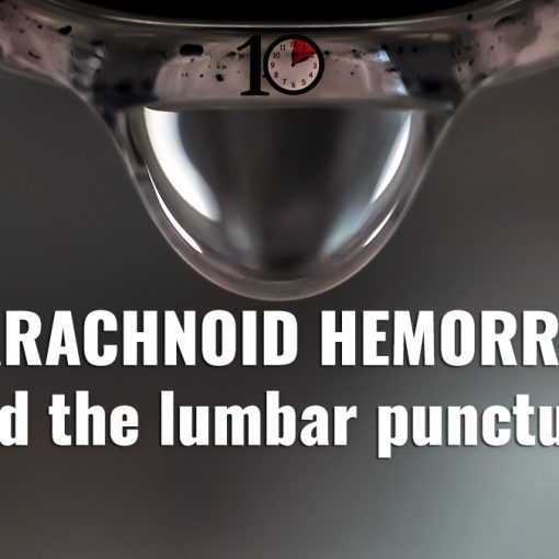 Subarachnoid Hemorrhage and Lumbar Puncture