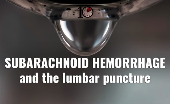 Subarachnoid Hemorrhage and Lumbar Puncture