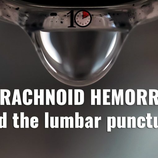 Subarachnoid Hemorrhage and Lumbar Puncture