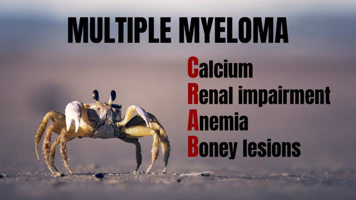 MULTIPLE-MYELOMA-CRAB