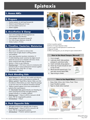 Epistaxis - 1 - First10EM