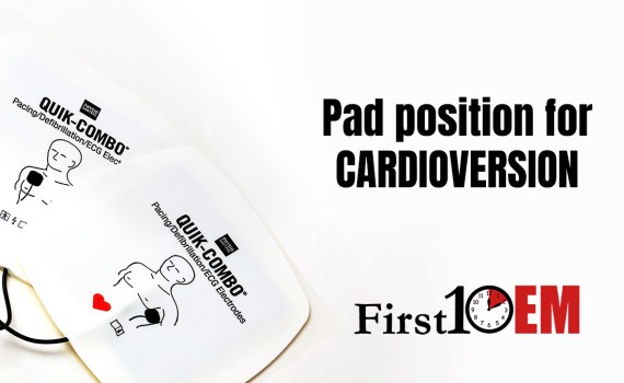 Pad position for cardioversion of atrial fibrillation