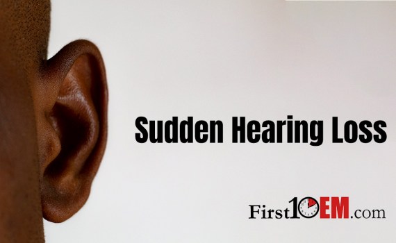 Sudden hearing loss