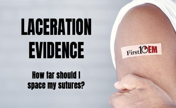 First10EM how far should I space sutures