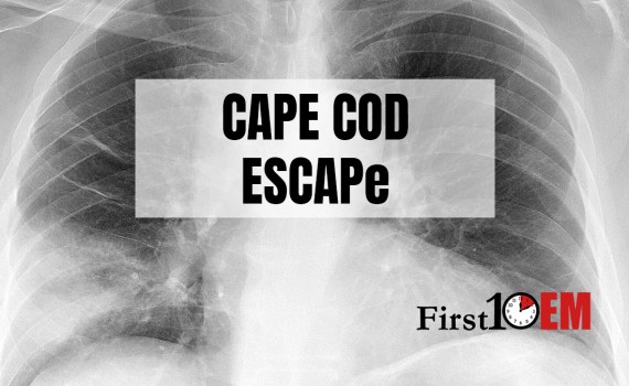 Steroids for pneumonia CAPE COD ESCAPE