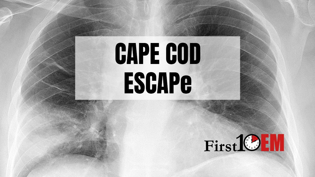 Steroids for pneumonia CAPE COD ESCAPE