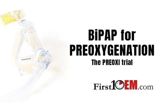 PREOXI trial BiPAP for preoxygenation