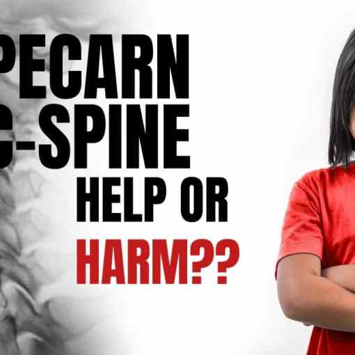 Is the PECARN cspine rule actually going to be harmful??