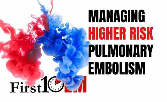 Managing High Risk pulmonary embolism
