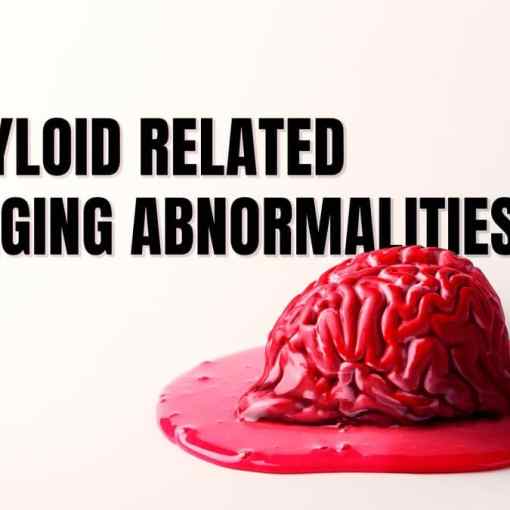 Amyloid-related imaging abnormalities FIRST10em