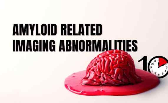 Amyloid-related imaging abnormalities FIRST10em